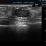 Ultraschall_11