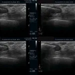 Ultraschall_12