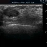 Ultraschall_16