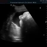 Ultraschall_20