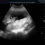 Ultraschall_3