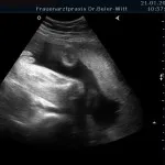 Ultraschall_6