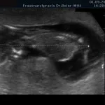 Ultraschall_99